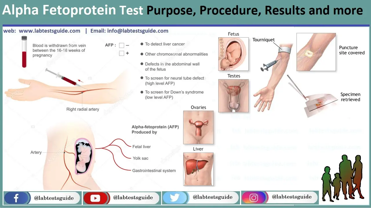 Alpha-fetoprotein (AF) &#8211; what is it, when to test, the importance of AF in pregnancy, analysis of test results