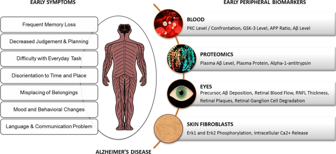 Alzheimer&#8217;s detectable from forty