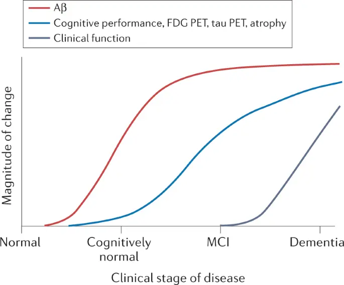 Alzheimer&#8217;s &#8211; these may be the first symptoms long before the disease. New study