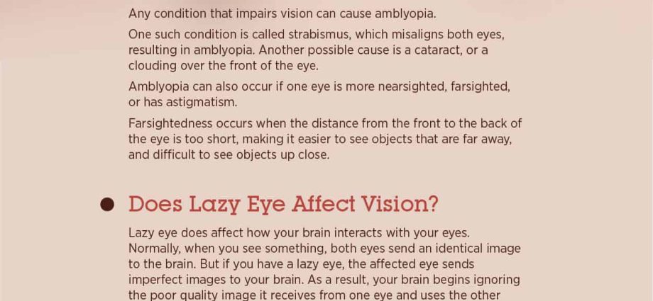 Amblyopia (lazy eye) &#8211; causes, treatment