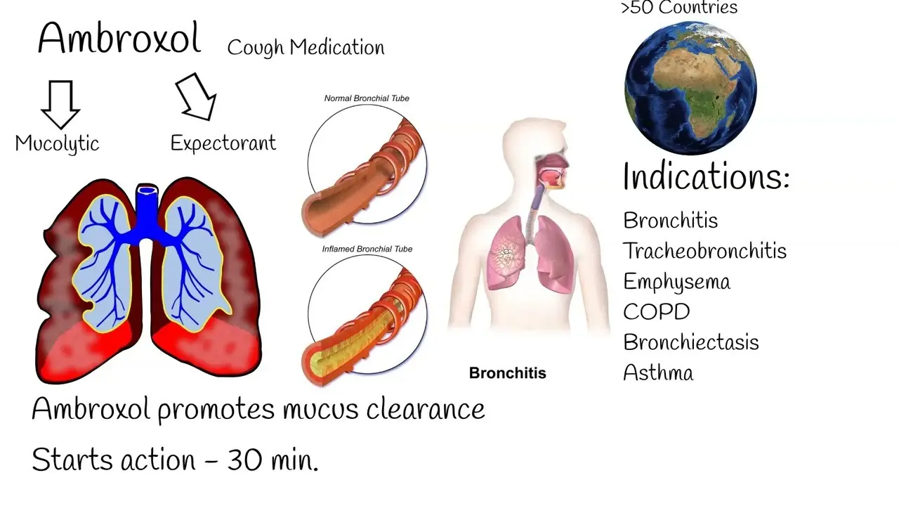 Ambroxol Nycomed for acute and chronic respiratory diseases. How to use?