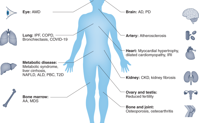 AMD &#8211; an age-related condition