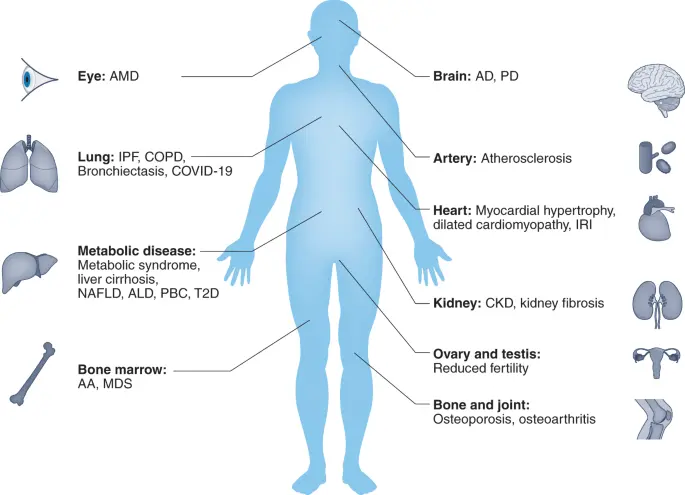 AMD &#8211; an age-related condition