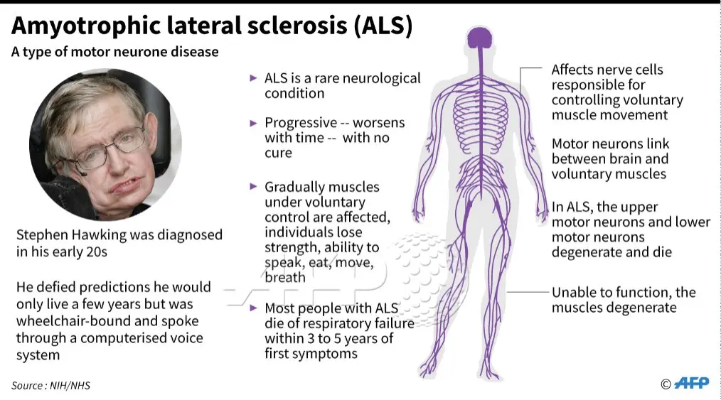 Amyotrophic lateral sclerosis &#8211; a deadly disease from which Stephen Hawking suffered