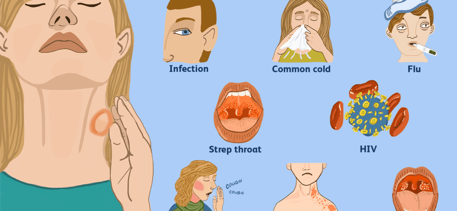 An enlarged lymph node in children. What could a lump on my neck mean?