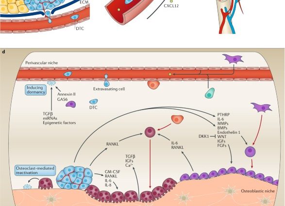 An enzyme that promotes prostate cancer metastasis has been identified