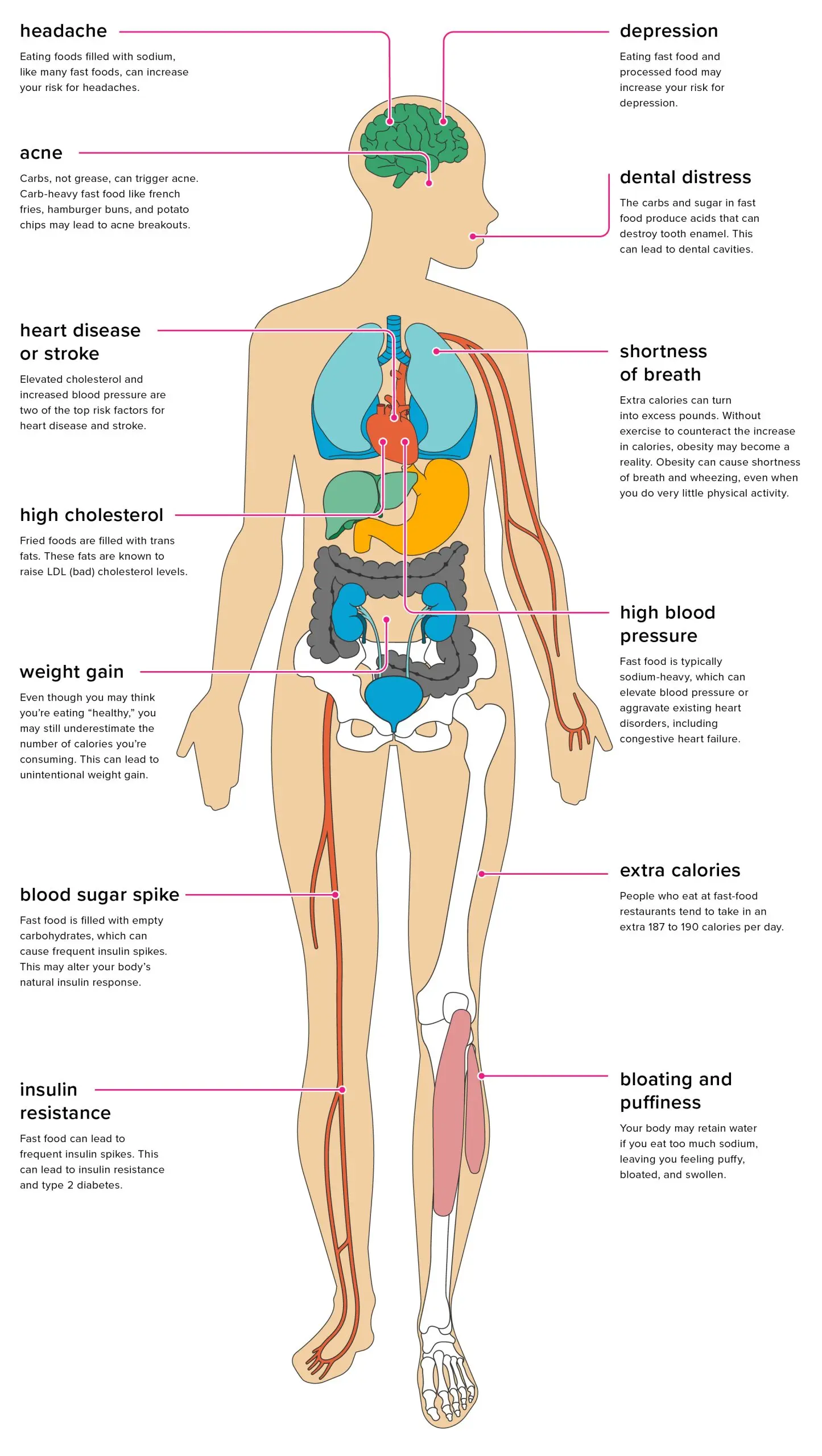 An excess of &#8220;fast&#8221; carbohydrates harms a woman&#8217;s heart