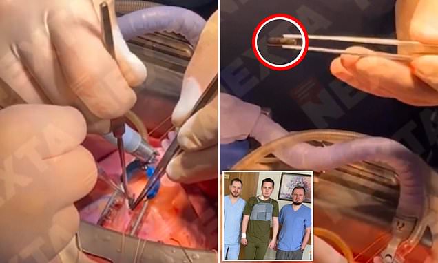 An unusual operation in Kiev. They took the bullet out of the beating heart of a soldier [VIDEO]