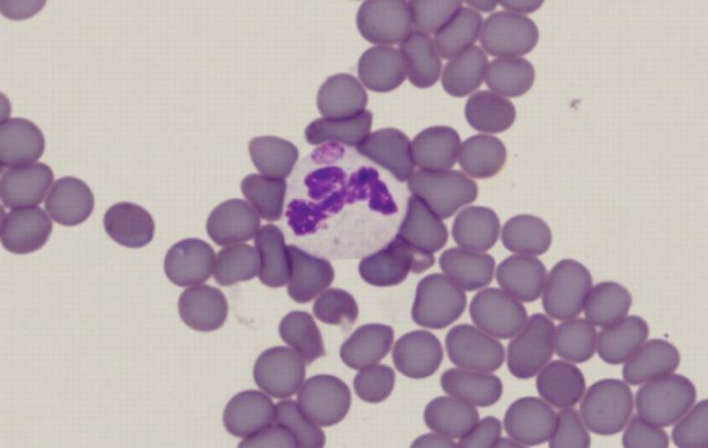 Anaplasmosis in cattle