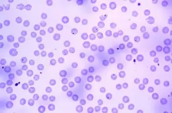 Anaplasmosis in cattle