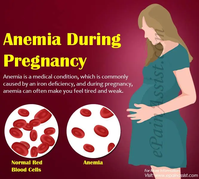 Anemia during pregnancy &#8211; can anemia cause fetal defects?