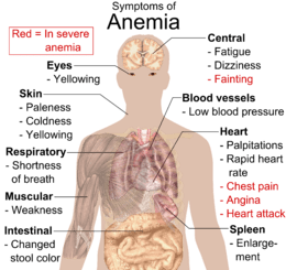 Anemia symptoms &#8211; characteristics, classifications, causes and effects