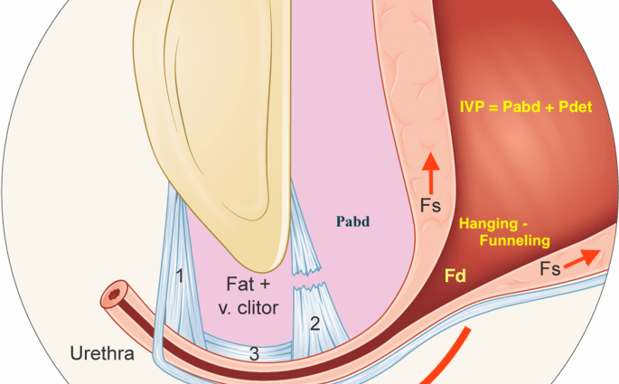 Anesthesia during childbirth protects against urinary incontinence