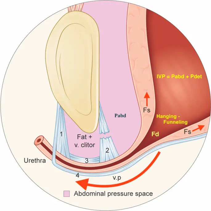 Anesthesia during childbirth protects against urinary incontinence