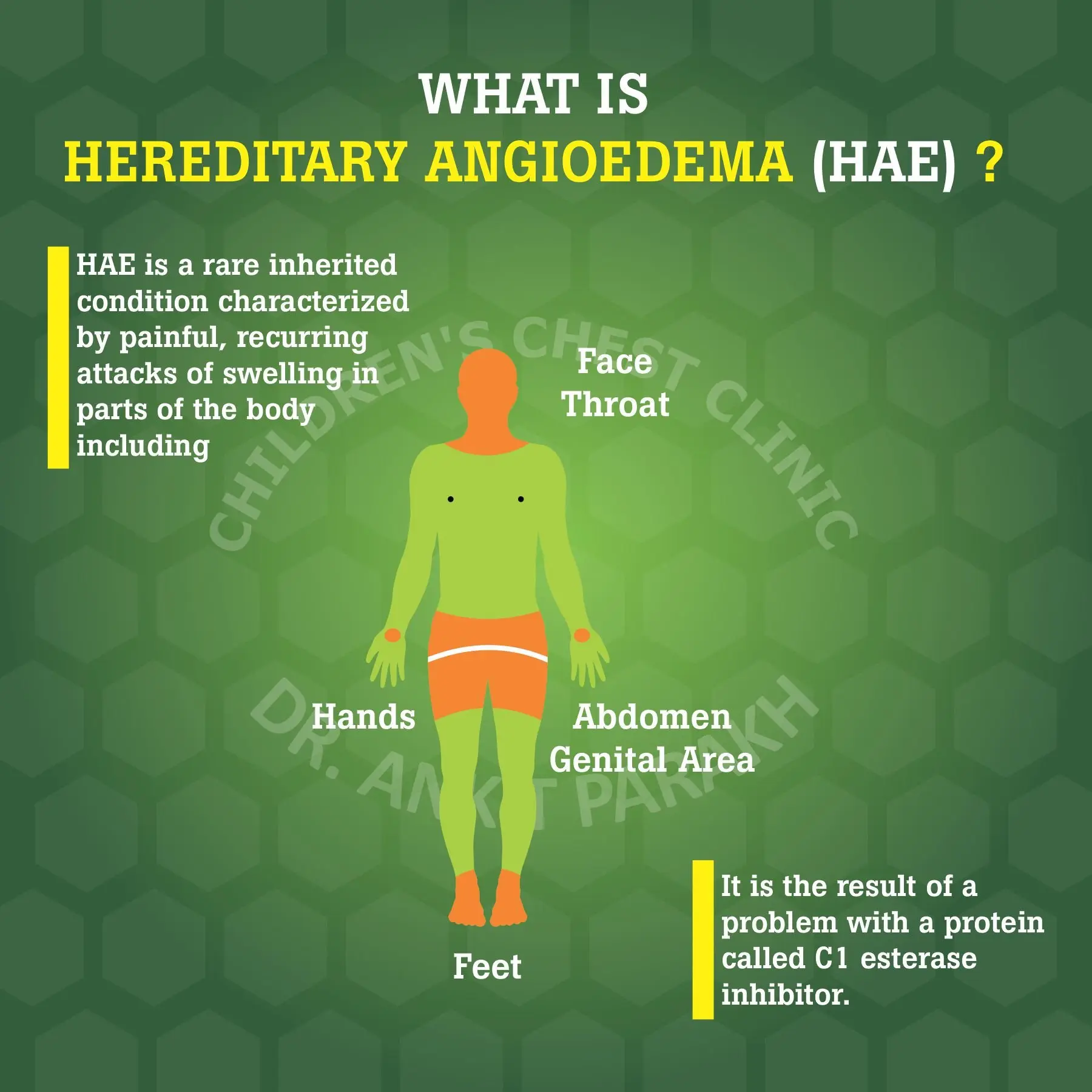 Angioedema &#8211; causes, types, symptoms, treatment, how to avoid