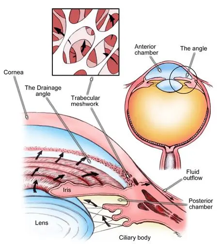 Angle-closure glaucoma &#8211; symptoms and treatment