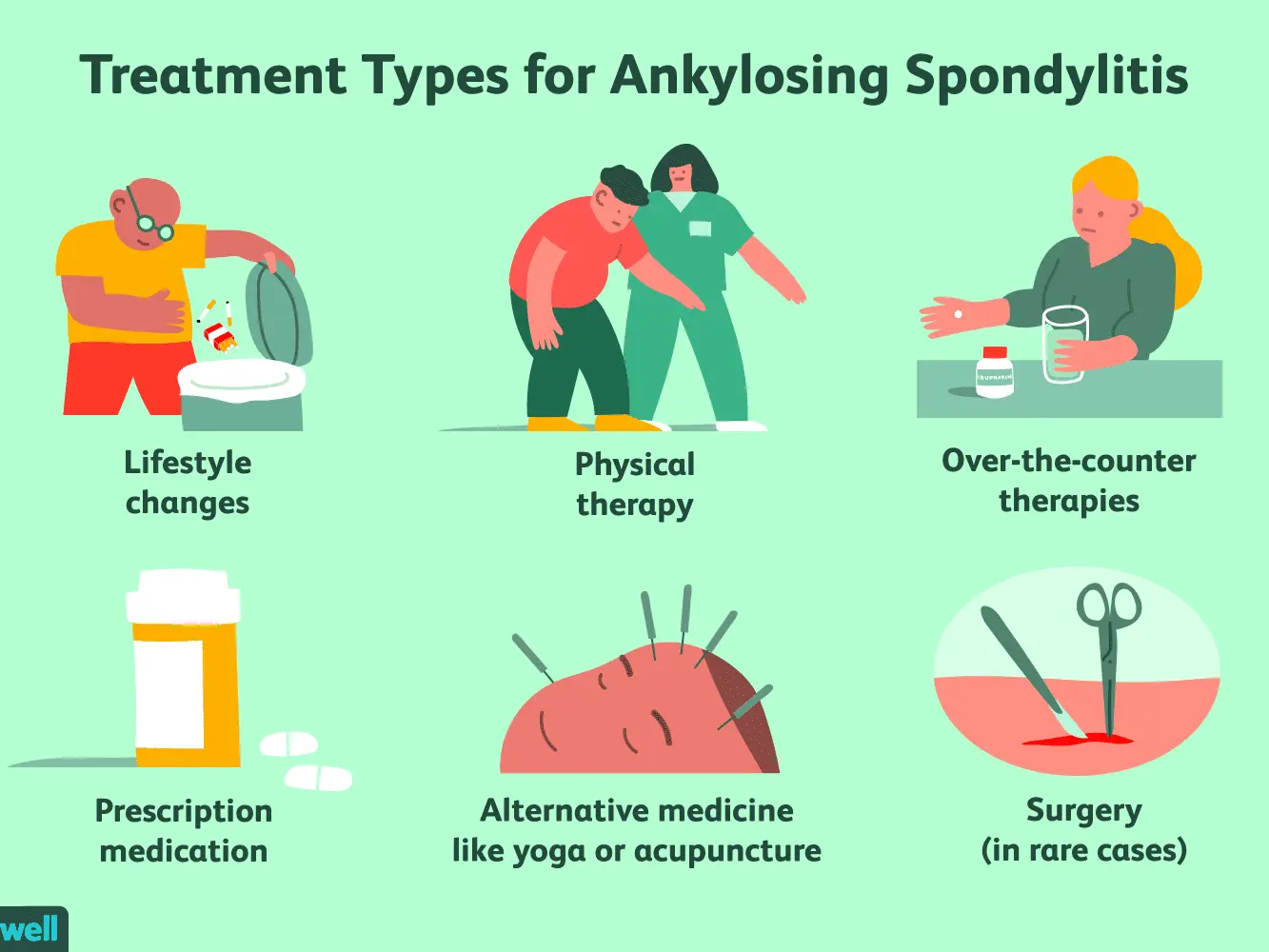 Ankylosing spondylitis &#8211; symptoms, prevention, treatment