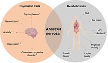 Anorexia nervosa &#8211; diagnosis, symptoms, causes, picture of the disease