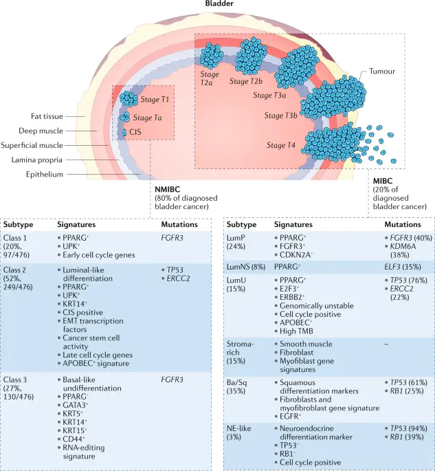 Another sequence responsible for bladder cancer has been discovered