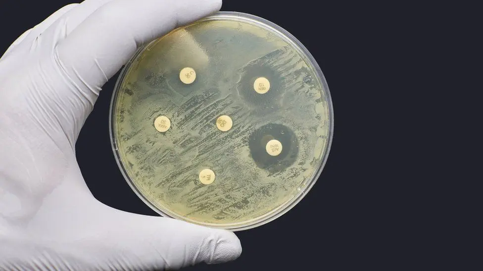 Antibiotic resistance &#8211; the plague of the XNUMXst century. Drug-resistant bacteria kill millions of people every year [NEW PANDEMIC?]