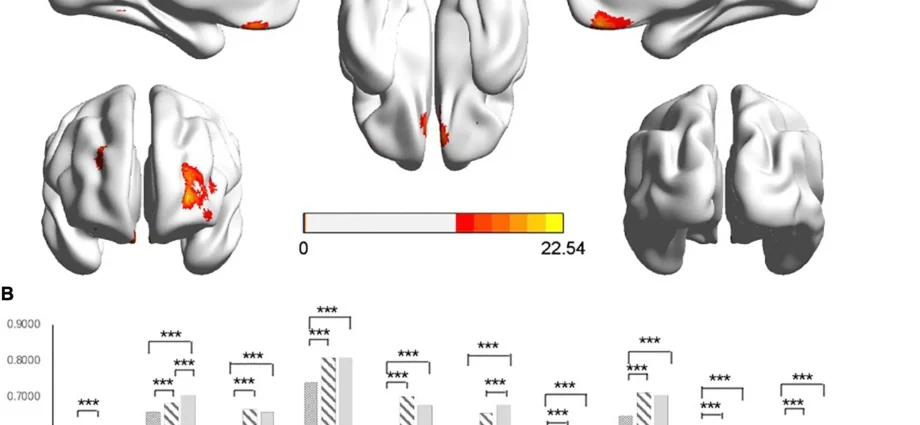 Antipsychotic drugs cause rapid changes in the volume of the brain