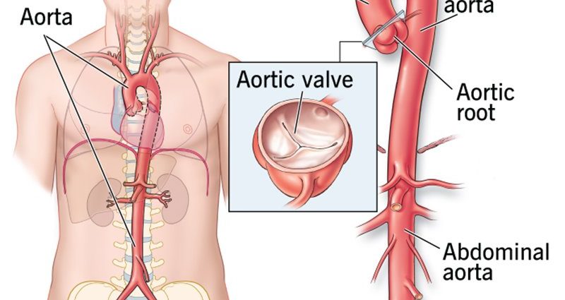 Aorta &#8211; the main human artery