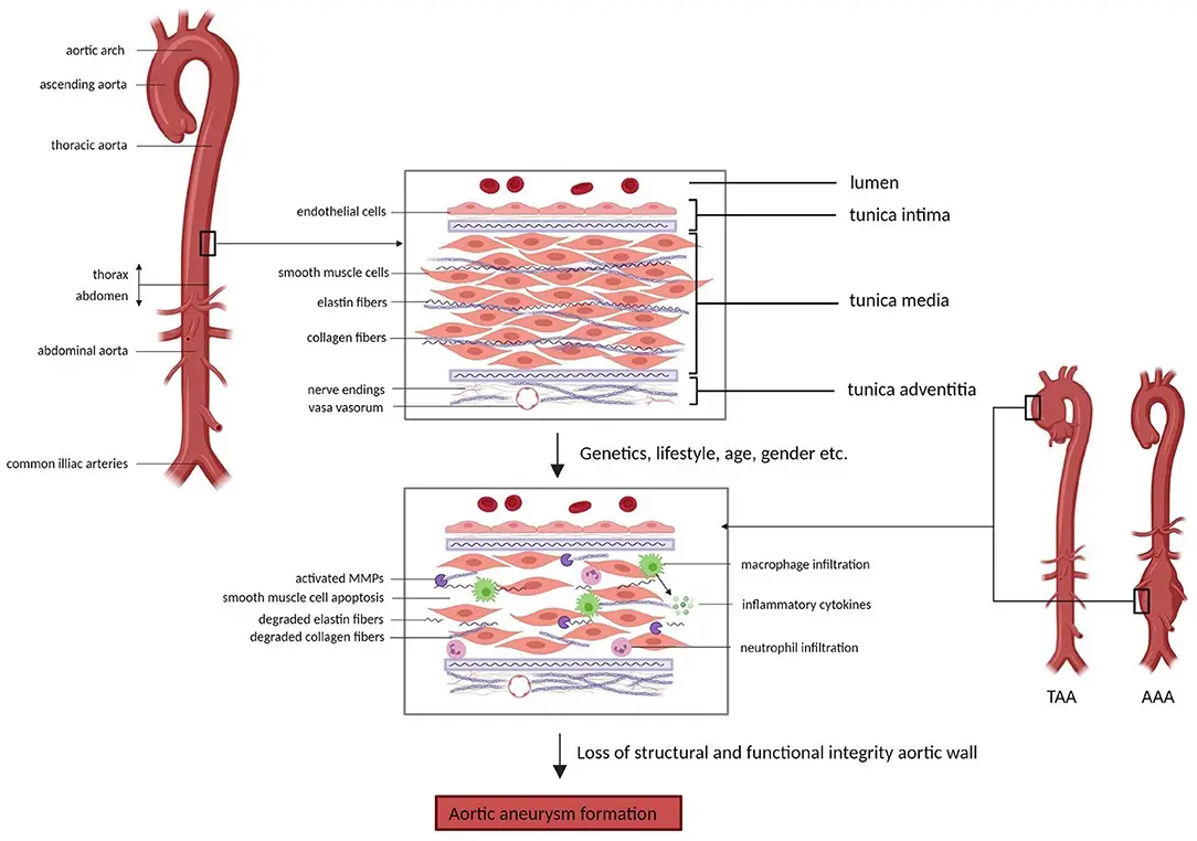 Aortic aneurysm prophylactic examinations are starting in Kujawsko-Pomorskie