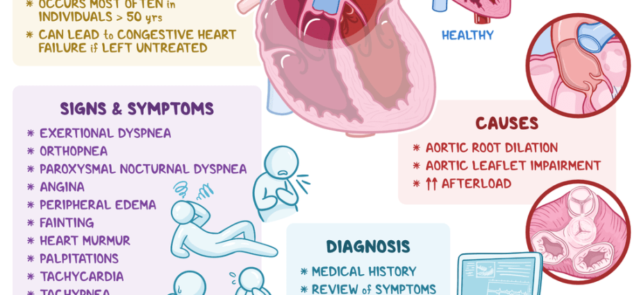 Aortic regurgitation &#8211; causes, symptoms, treatment