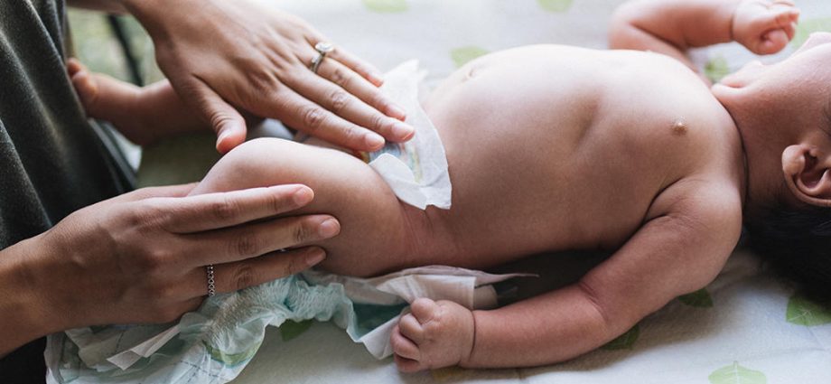 Are bacteria in your baby&#8217;s urine a cause for concern?
