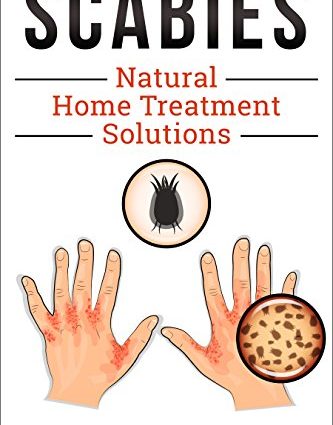 Are there home treatments for scabies?