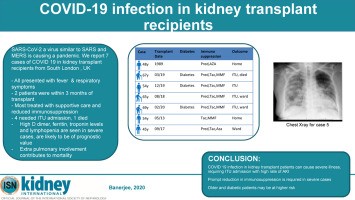 Are transplant recipients particularly at risk of coronavirus?