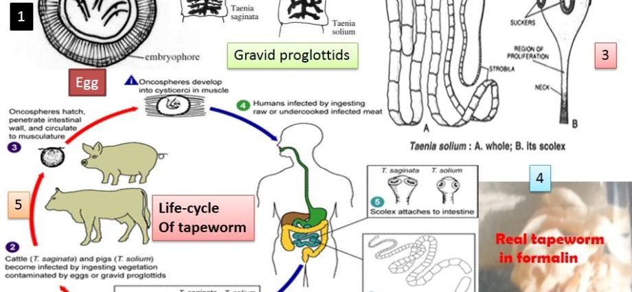 Armed tapeworm &#8211; symptoms, treatment and life cycle