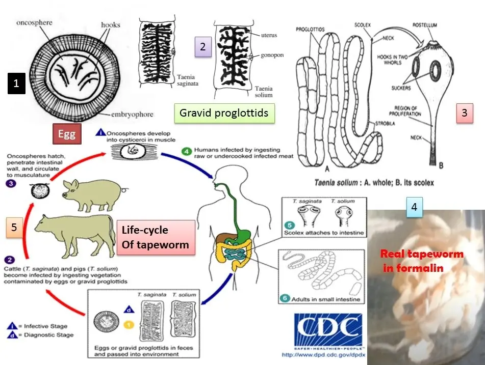 Armed tapeworm &#8211; symptoms, treatment and life cycle