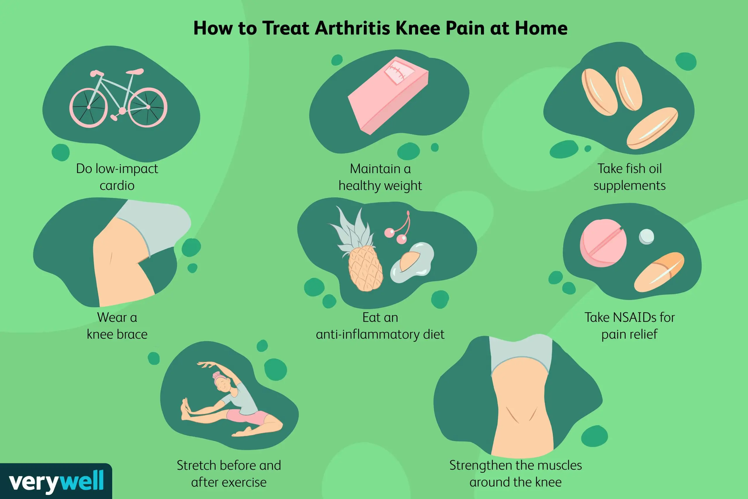 Arthrosis &#8211; causes, symptoms, treatment. Effects of topical medications on joint degeneration