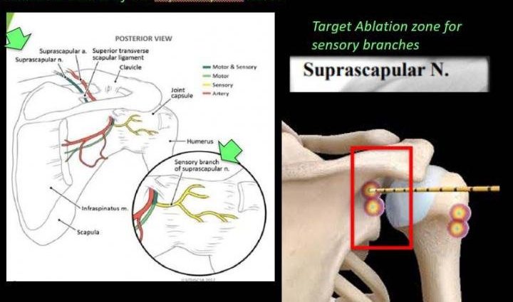 Articular bag. Treatment and rehabilitation in case of contusion of the joint capsule