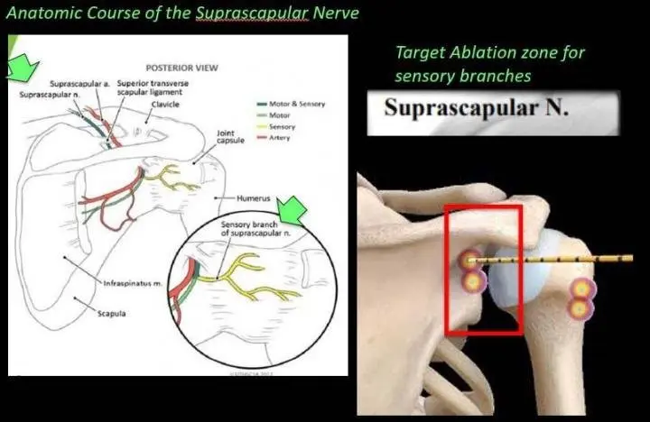 Articular bag. Treatment and rehabilitation in case of contusion of the joint capsule