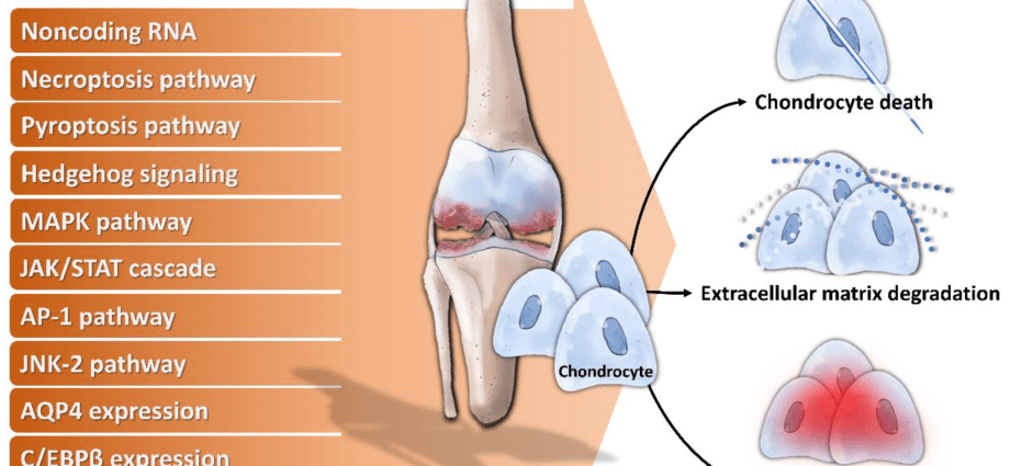 Articular cartilage preparations in the treatment of RA