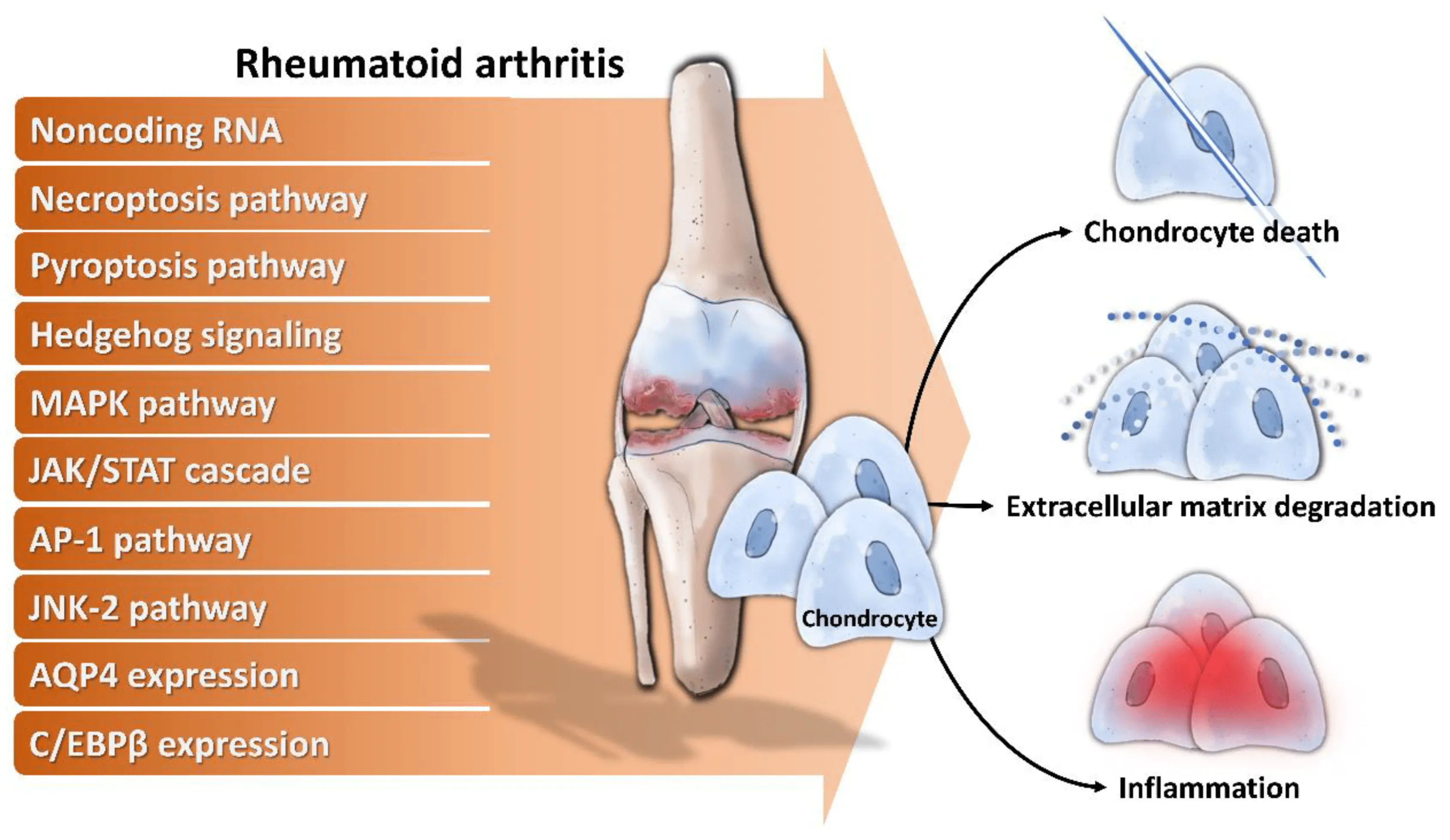 Articular cartilage preparations in the treatment of RA