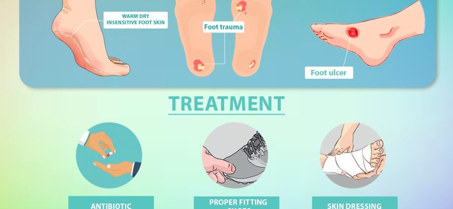 &#8220;Artificial skin&#8221; for the treatment of the diabetic foot