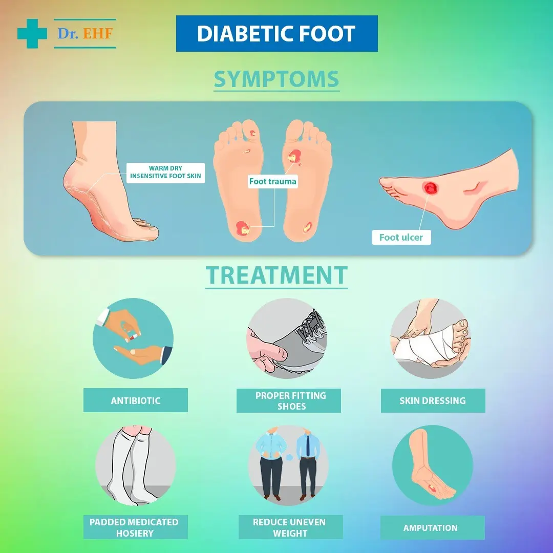 &#8220;Artificial skin&#8221; for the treatment of the diabetic foot