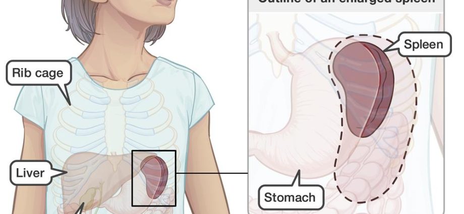 As the spleen grows, test the blood! It could be a genetic disease