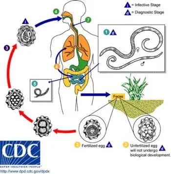 Ascariasis &#8211; symptoms, treatment