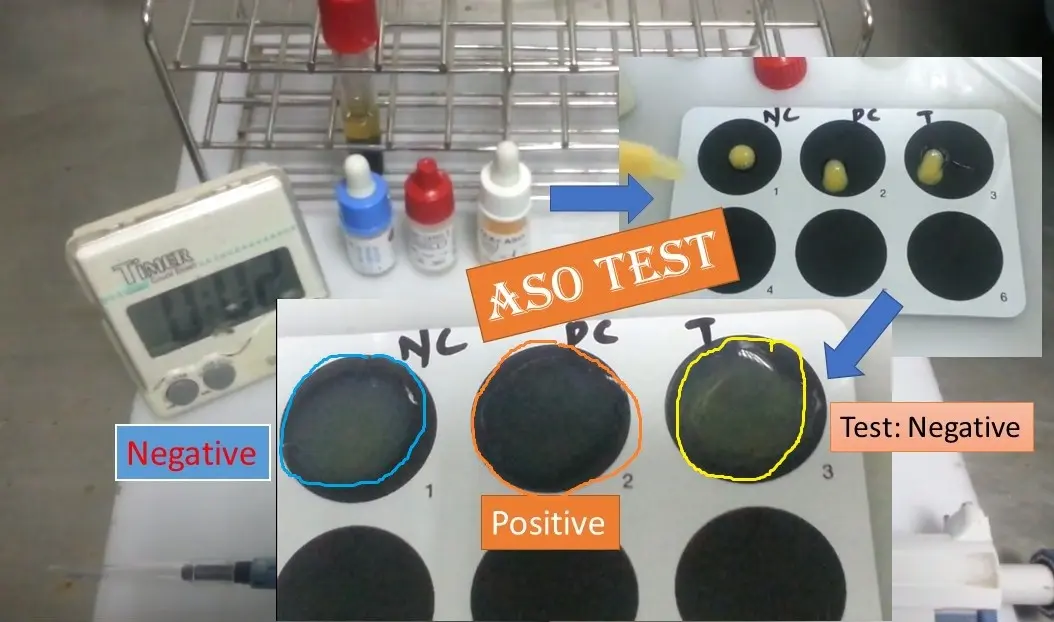 ASO test &#8211; indications, standards and result interpretation. When to perform an ASO test?