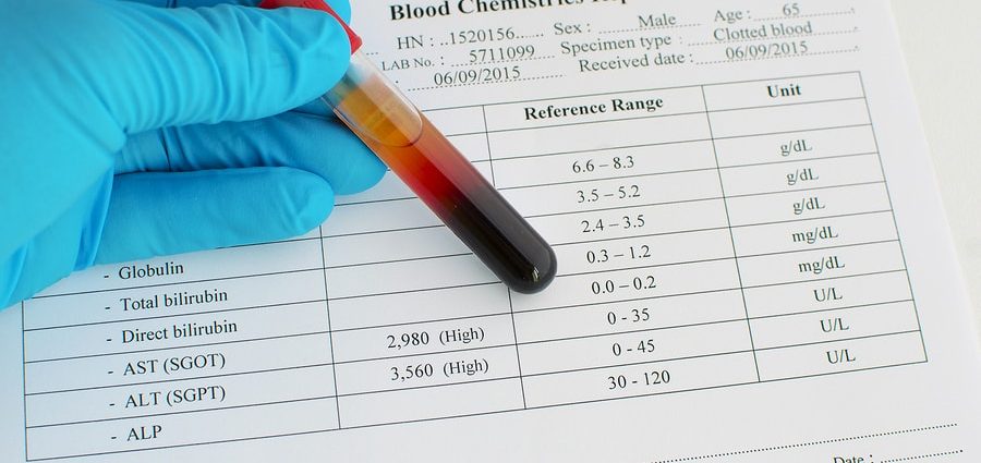 Aspartate aminotransferase (AST) &#8211; what is it, when to do the test, interpretation of results