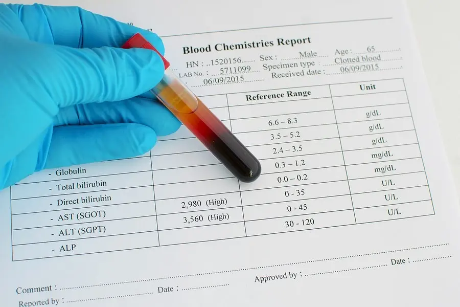 Aspartate aminotransferase (AST) &#8211; what is it, when to do the test, interpretation of results