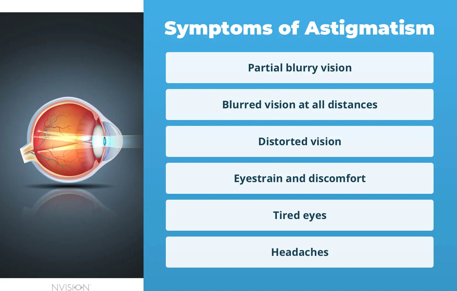 Astigmatism &#8211; causes, symptoms, astigmatism test, treatment [EXPLAINED]