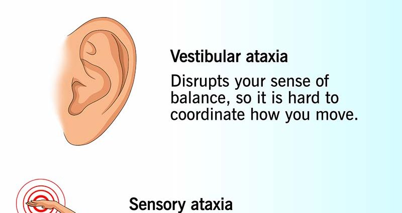 Ataxia &#8211; what is it, what are its mechanisms and how are it treated?