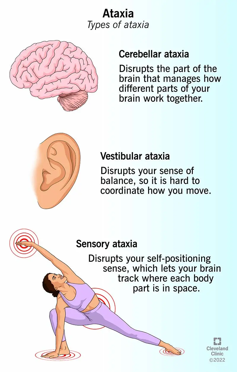 Ataxia &#8211; what is it, what are its mechanisms and how are it treated?