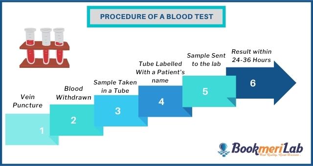 aTPO &#8211; test description, indications, mileage, price