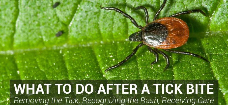 Attention! This is the biggest mistake when removing the tick. Never do that